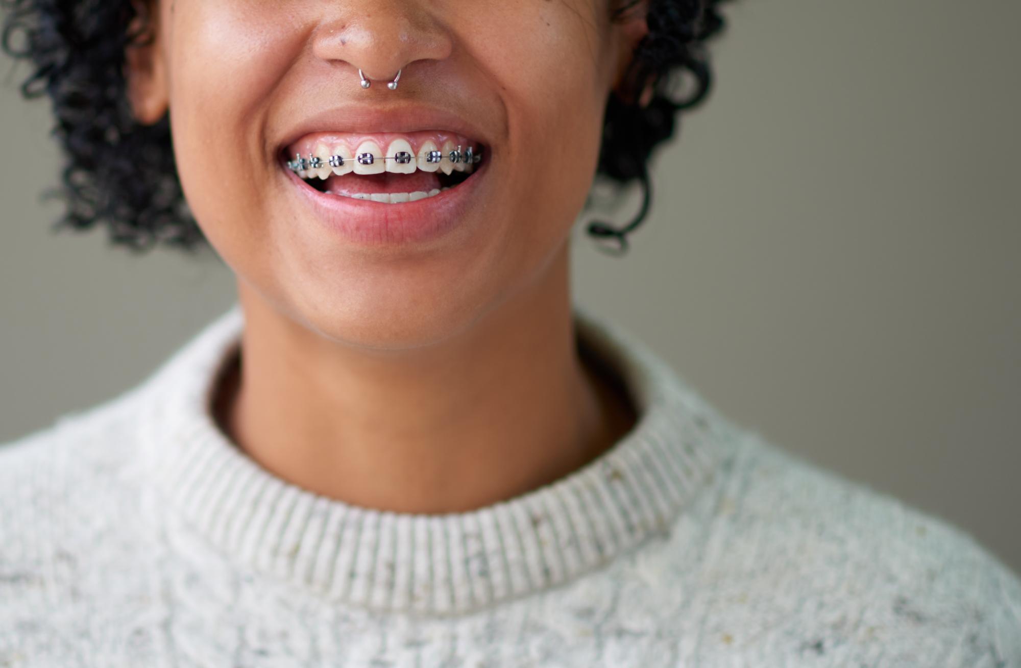 albany orthodontist