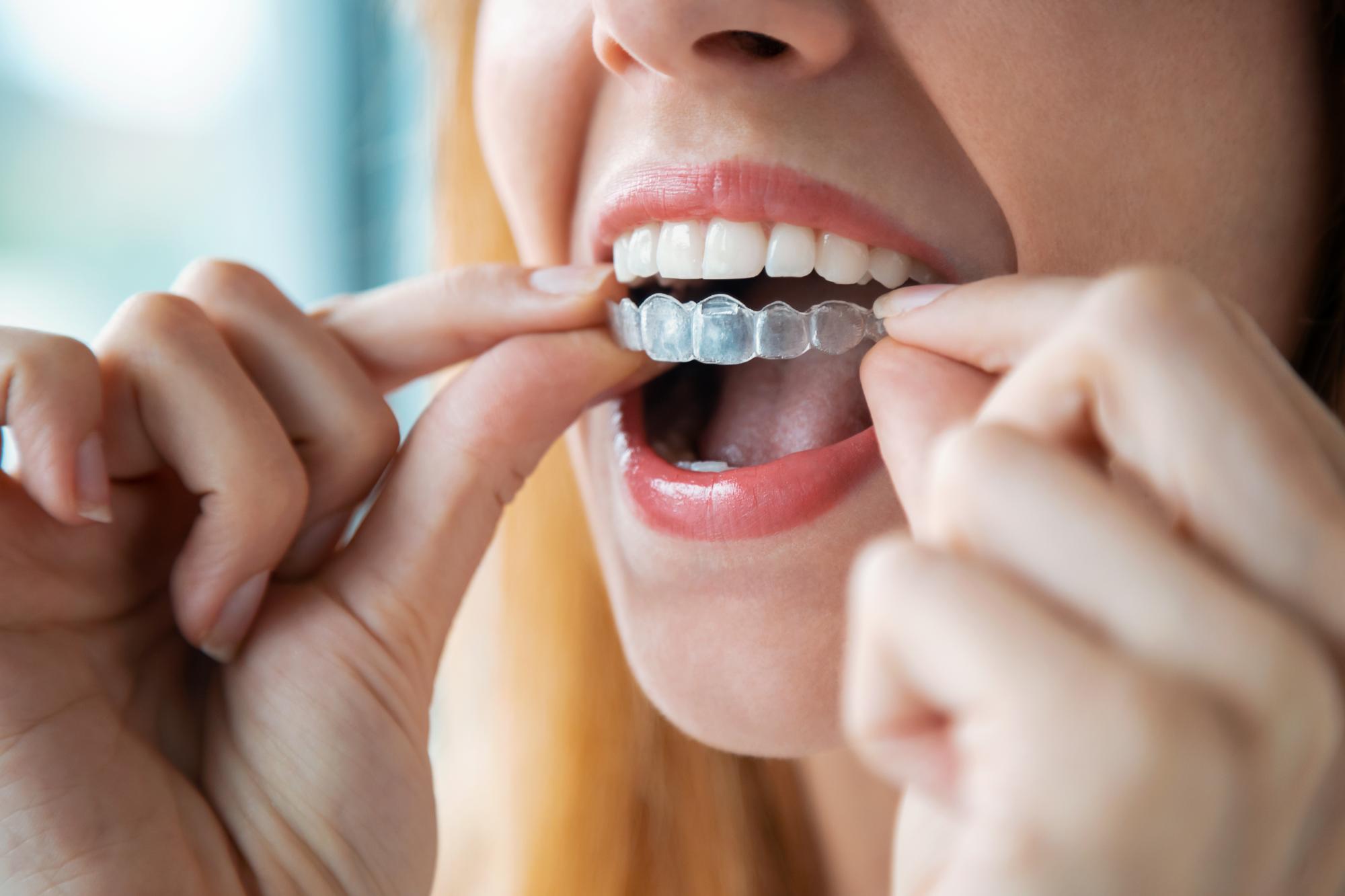 albany orthodontist