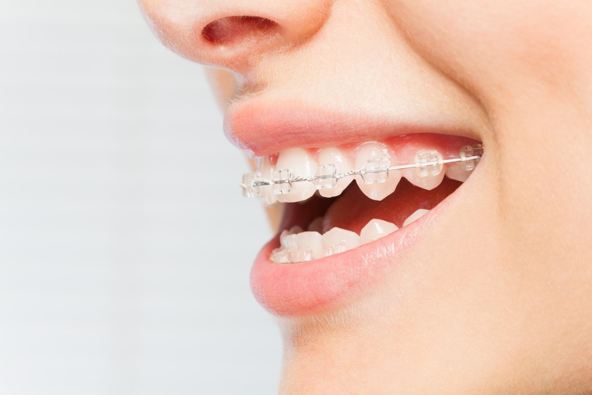 albany orthodontist
