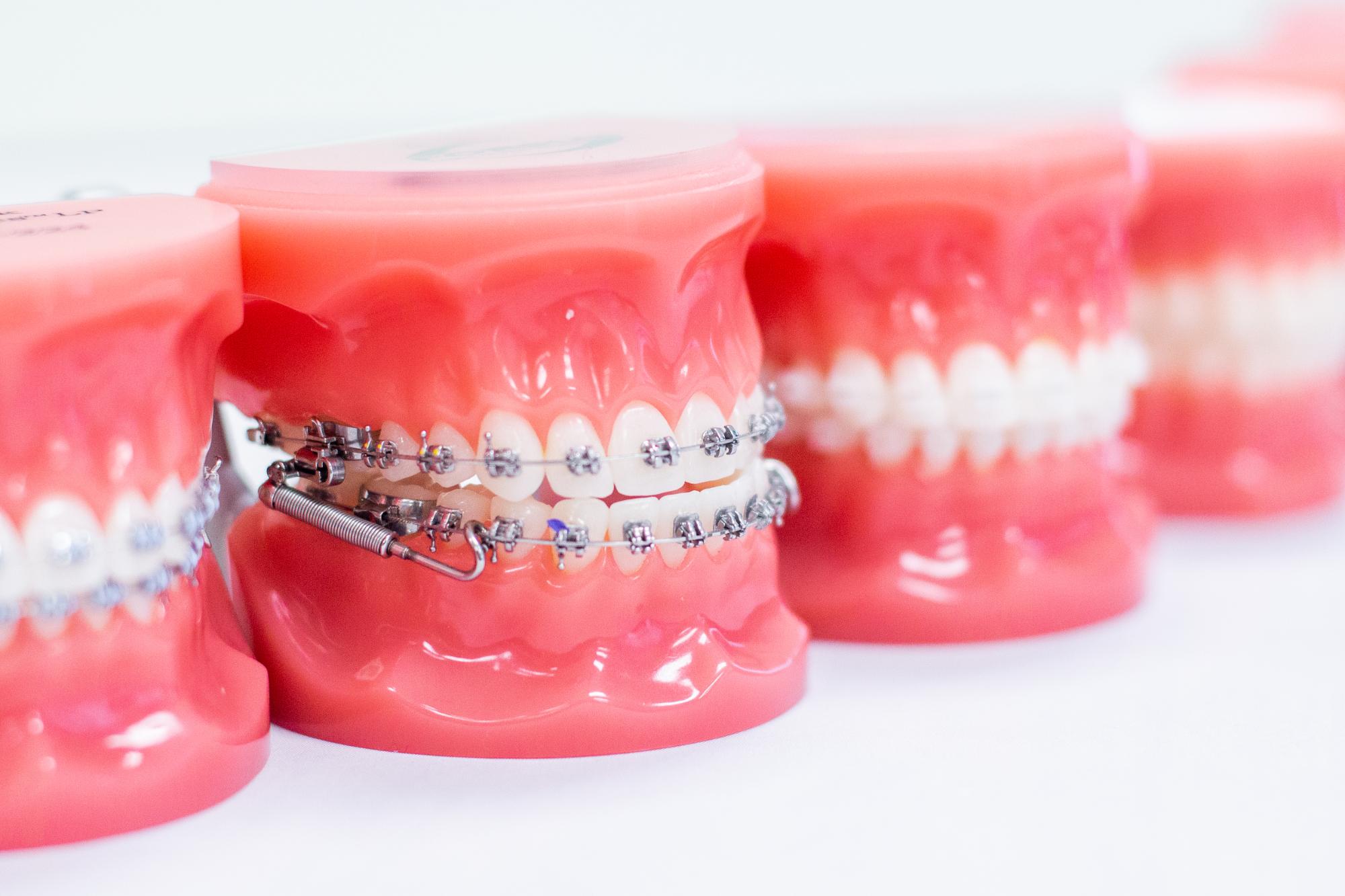 orthodontist in latham ny