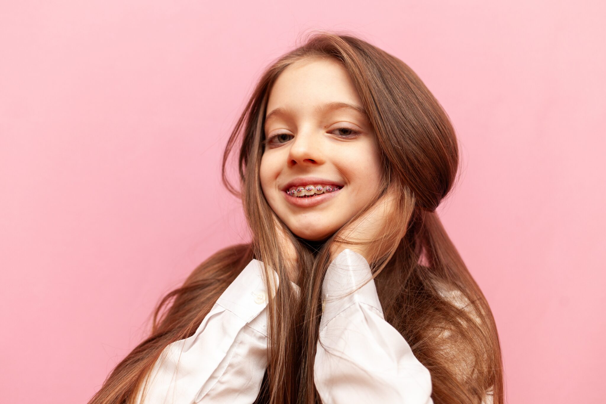 Young girl smiling with braces during the observation and recall stage of orthodontic care